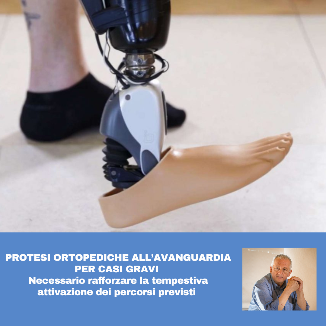 Al momento stai visualizzando PROTESI ORTOPEDICHE ALL’AVANGUARDIA PER CASI GRAVI – Necessario rafforzare la tempestiva attivazione dei percorsi previsti